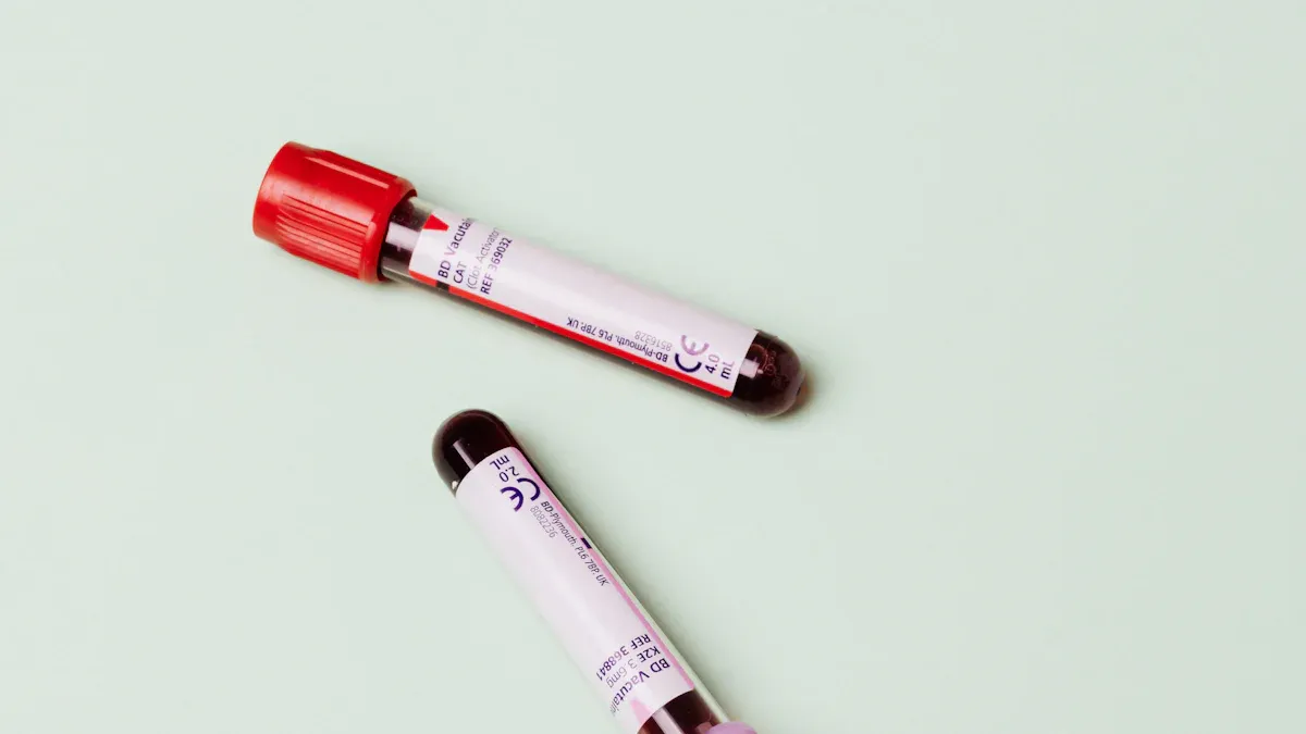 Types of Cat Blood Work